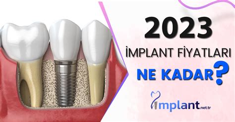 tek implant fiyatları